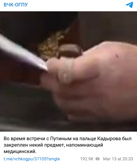 Рамзан Кадыров носит на пальце медицинский прибор