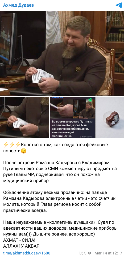 у Кадыров на пальце странный прибор