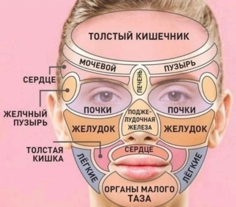 карта прыщей на лице у девушки