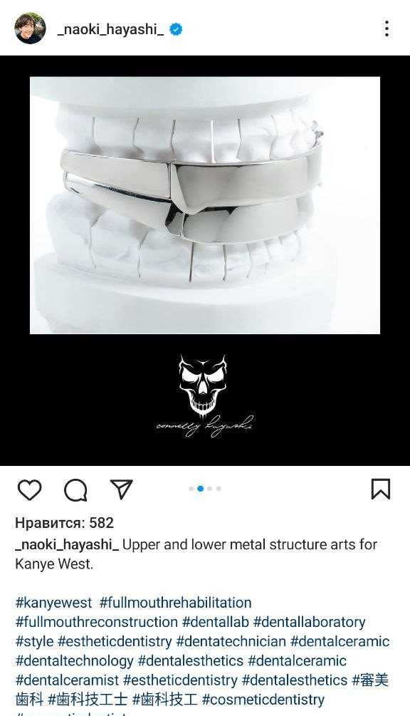 Hayashi About Kanye Teeth
