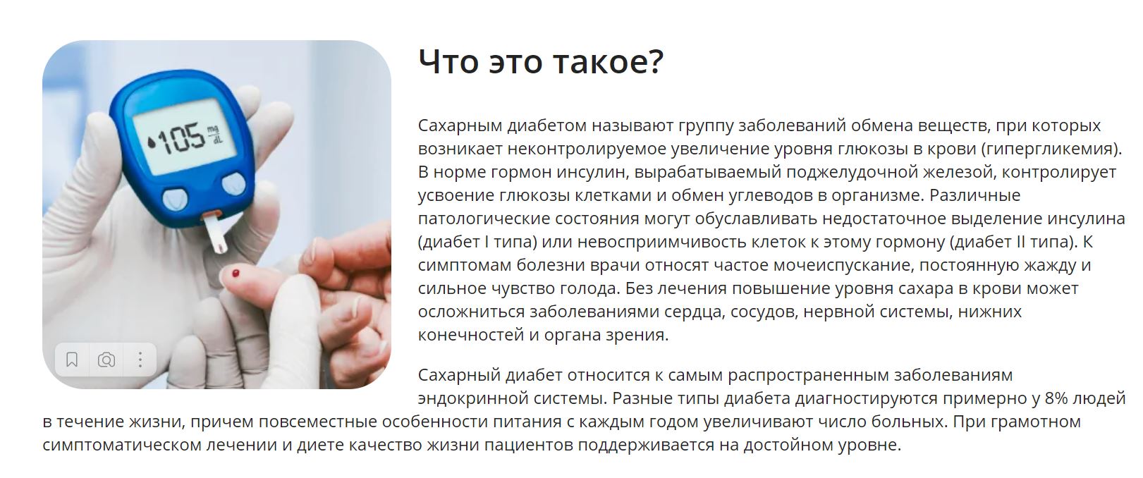Chto Jeto Takoe
