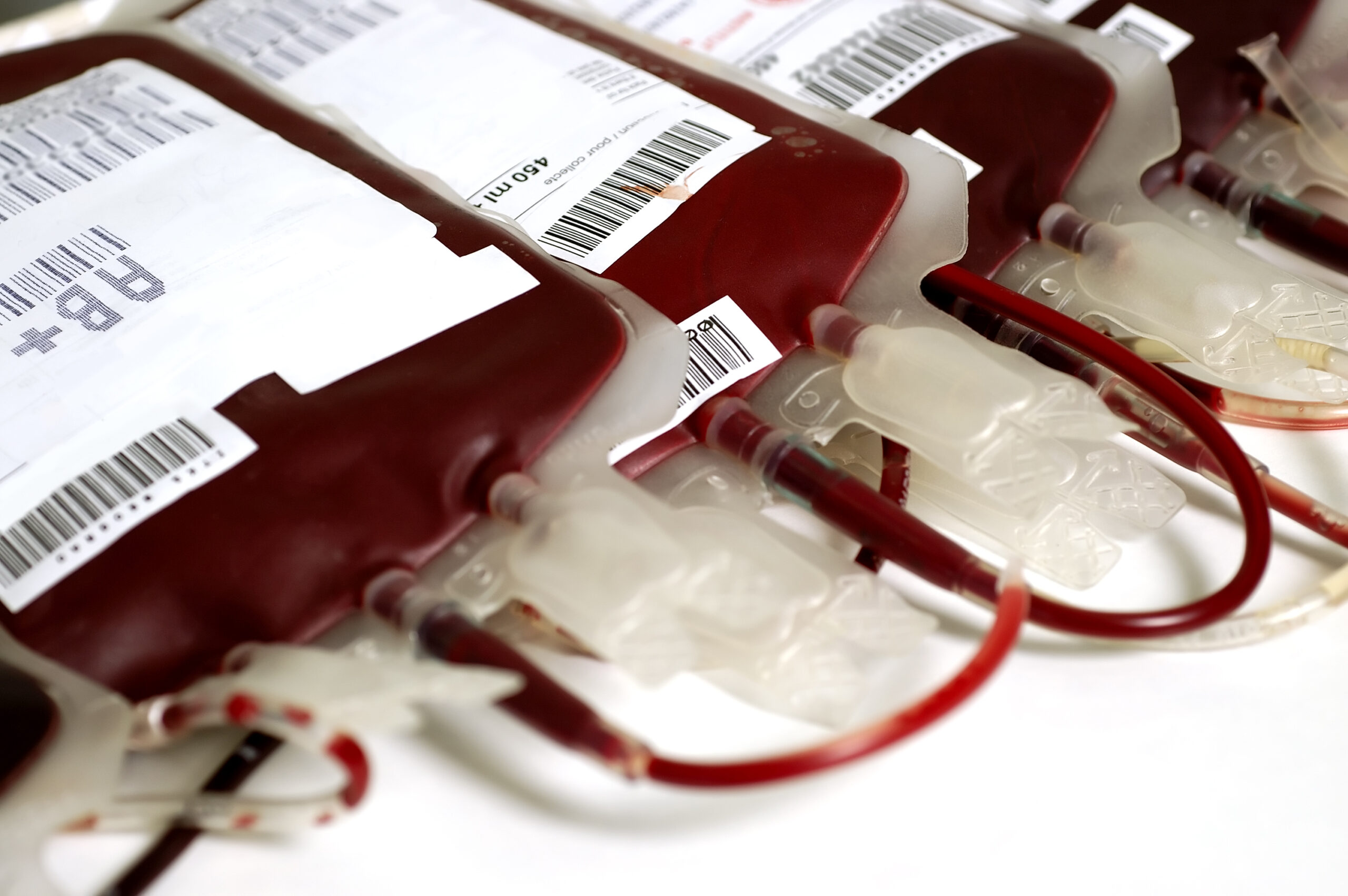 В тюменских медучреждениях нехватка крови для переливания